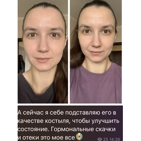 Леркапак — стикер для MAX