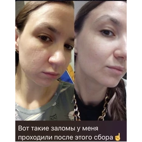 Леркапак — стикер для MAX