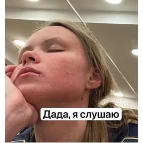 Лилька шпилька — стикер для MAX