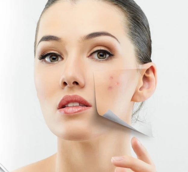Acne collection • Видео с удалением угрей, прыщей, чёрных точек и комедонов — канал в мессенджере MAX
