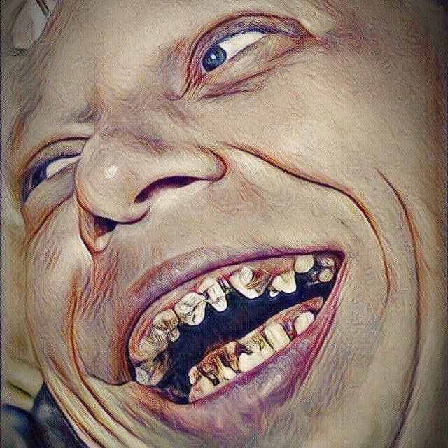ДИХЛОФОС(BigoLiveДругВокруг) — канал в мессенджере MAX