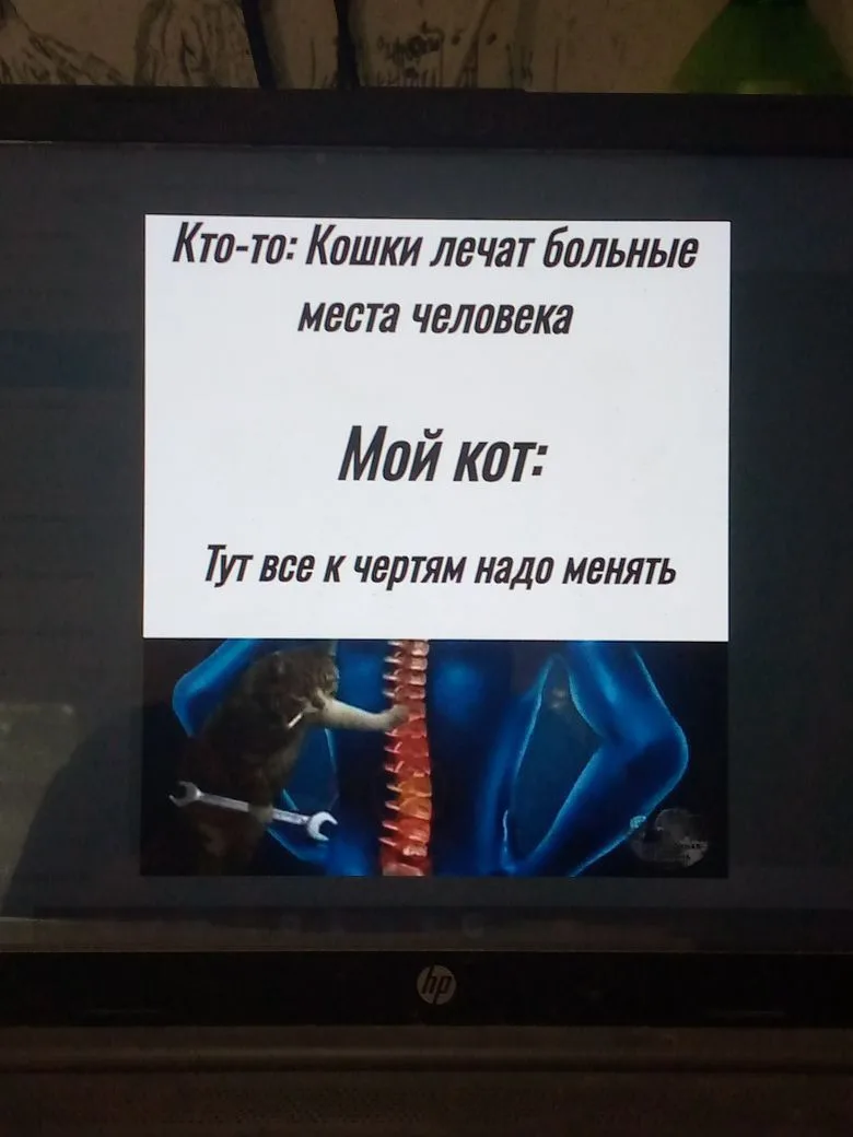 Сколиоз/кифоз у взрослых