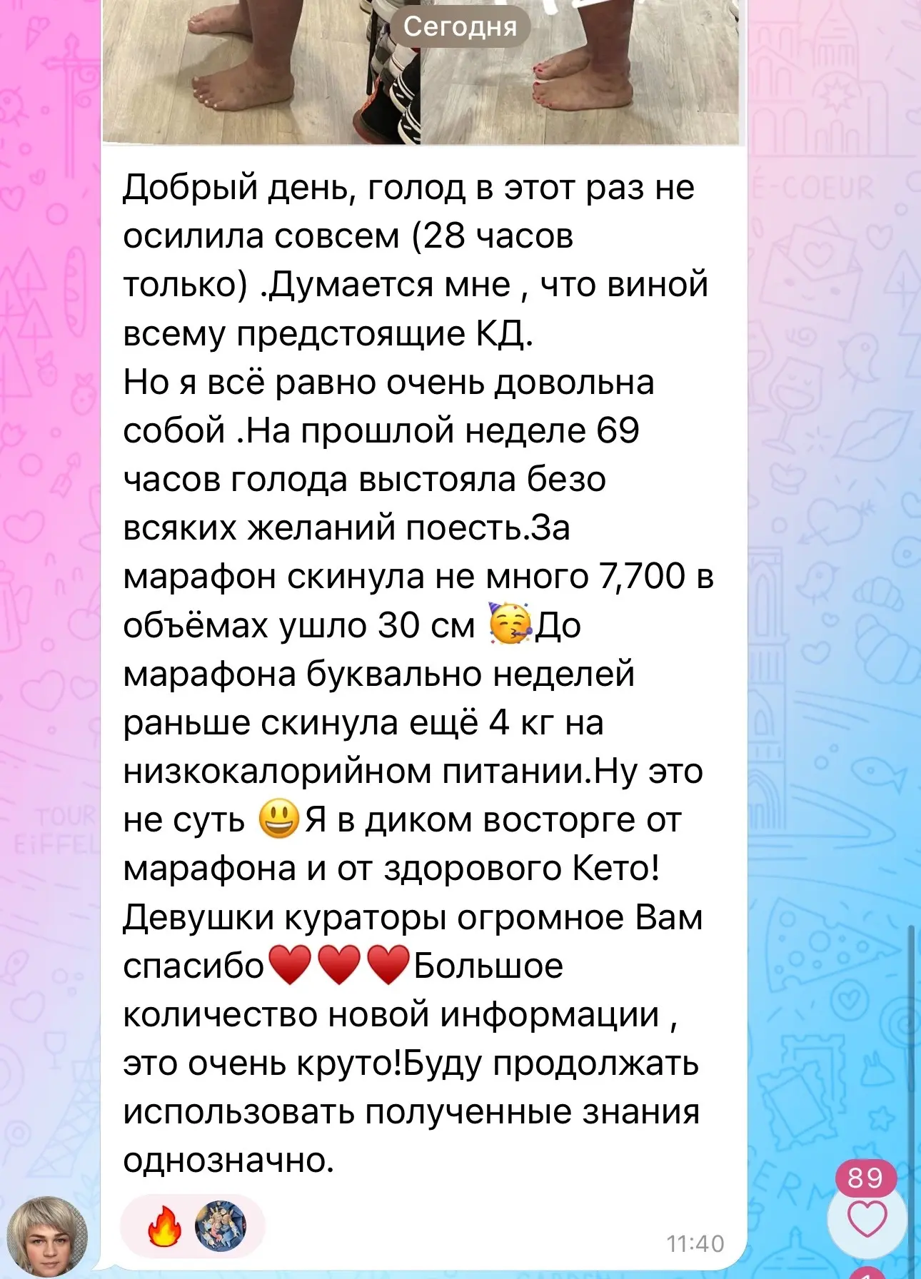 Изображение из сообщения канала