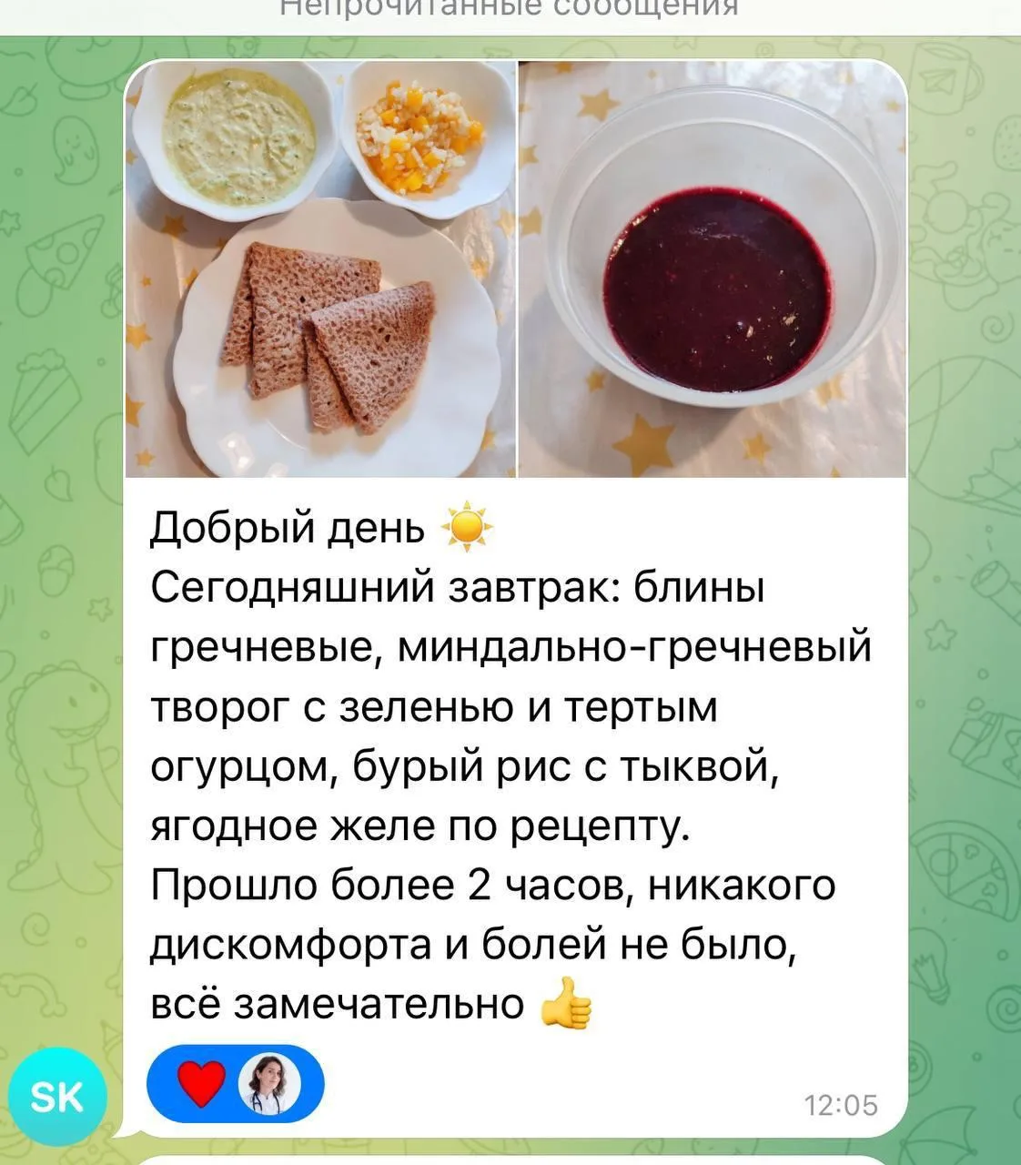 Изображение из сообщения канала