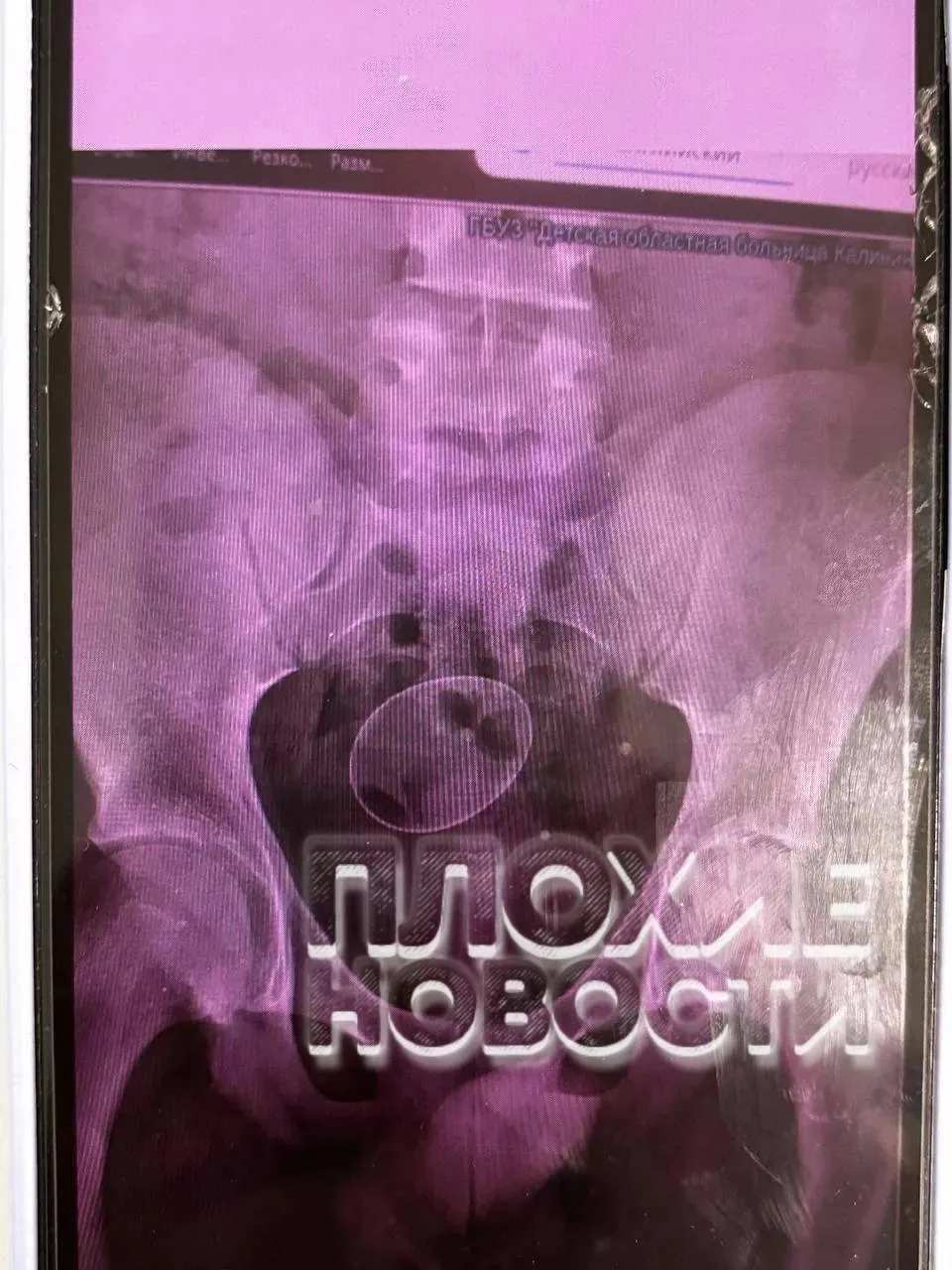 Изображение из сообщения канала