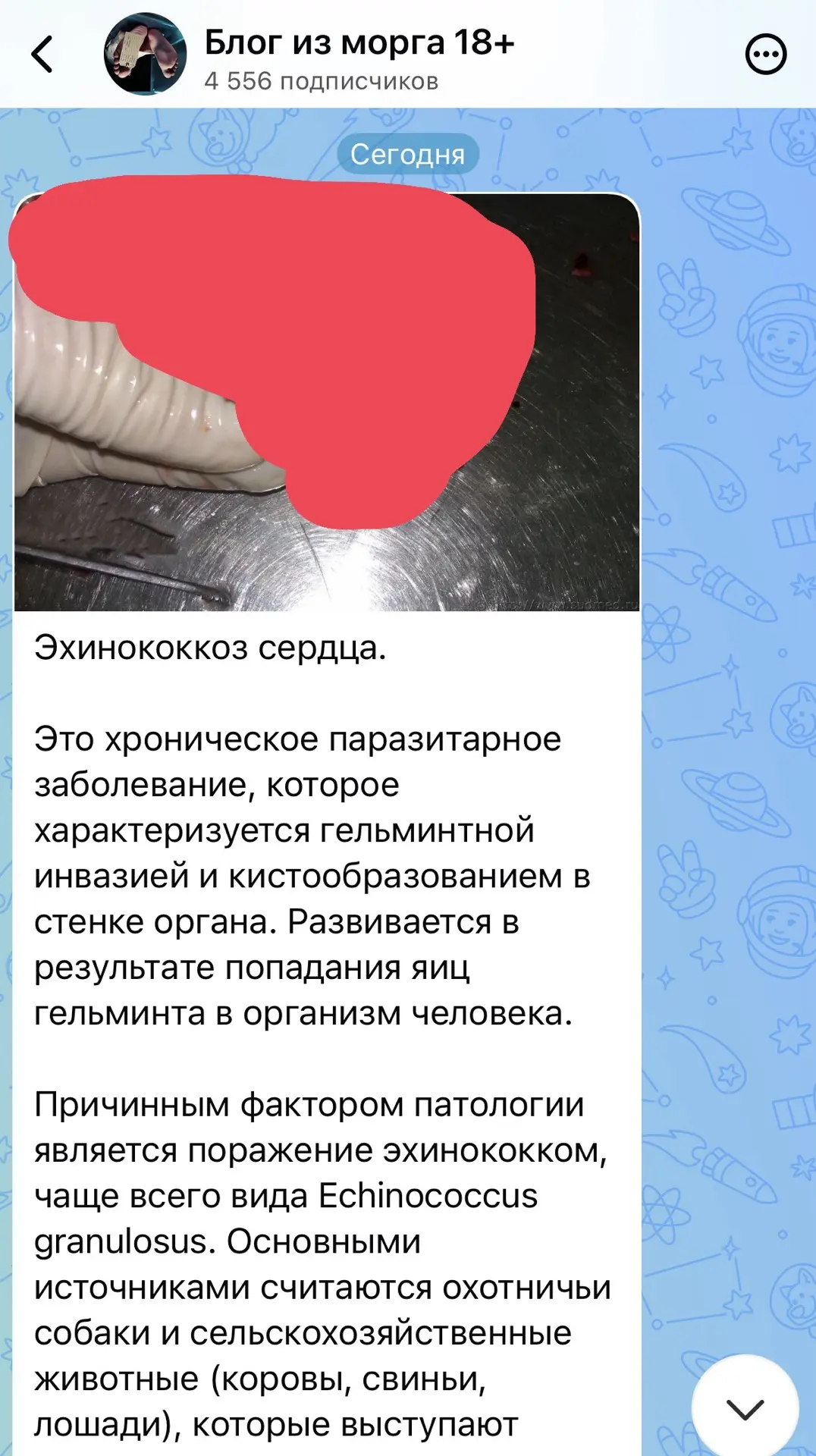 Изображение из сообщения канала