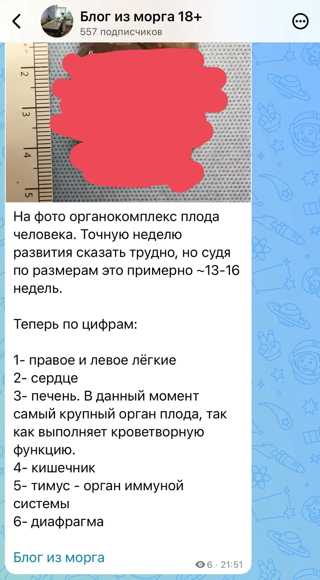 Изображение из сообщения канала