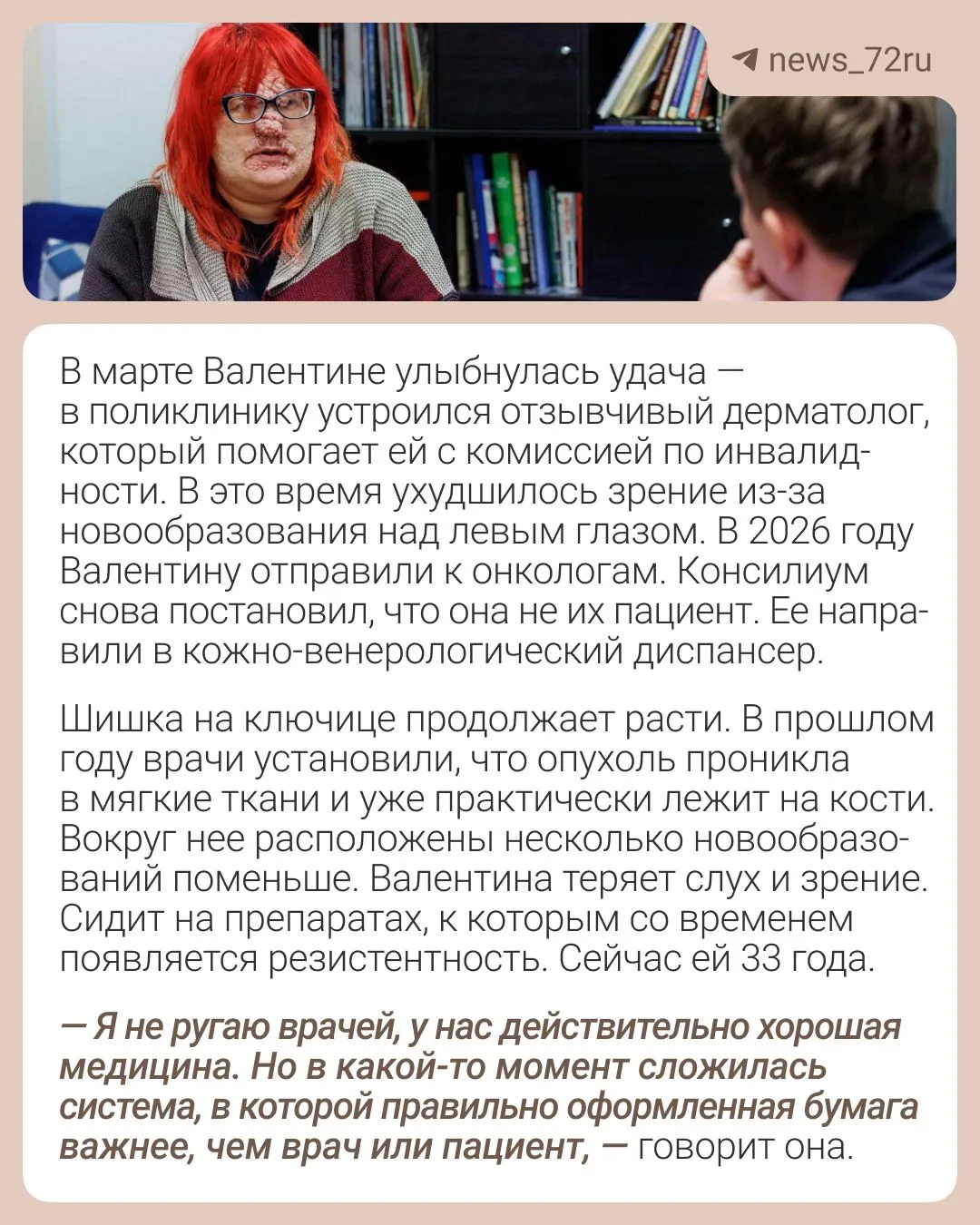 Изображение из сообщения канала