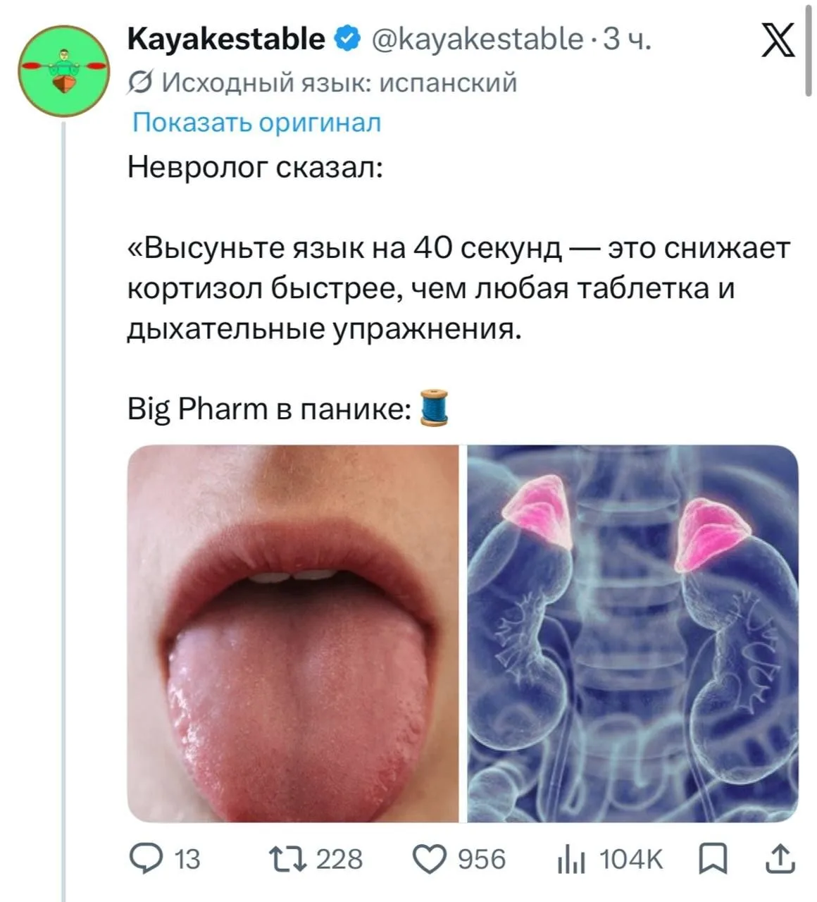 Изображение из сообщения канала