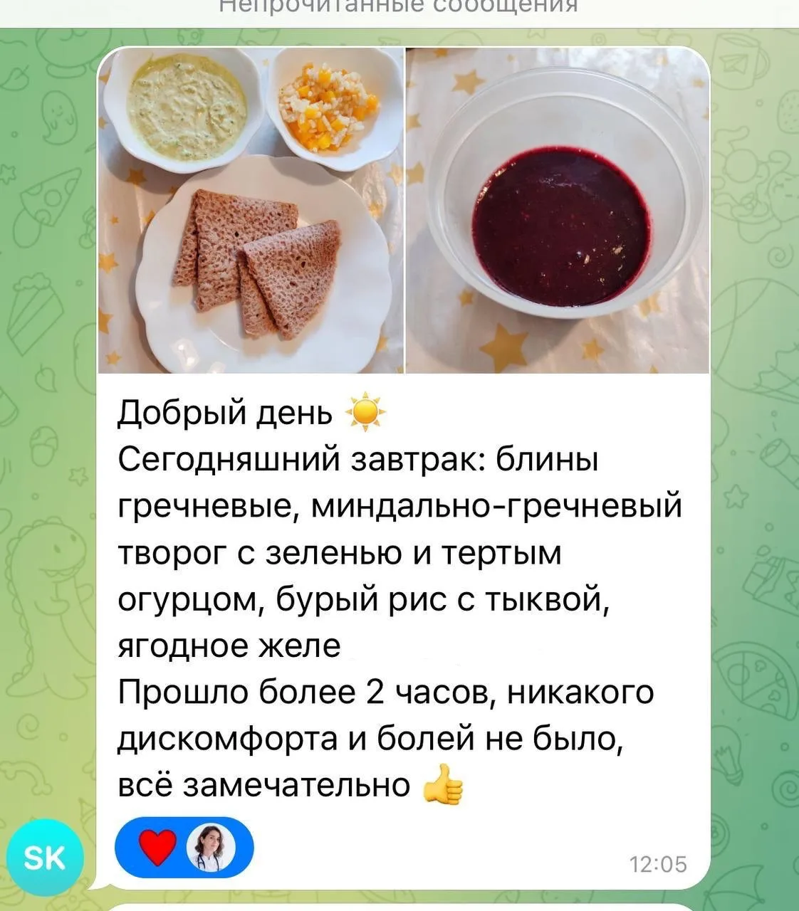 Изображение из сообщения канала