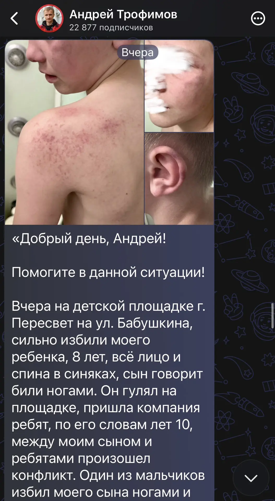 Изображение из сообщения канала