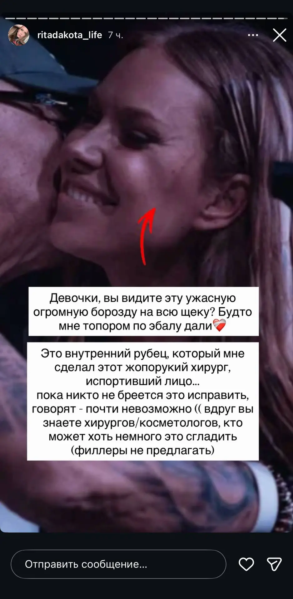 Изображение из сообщения канала