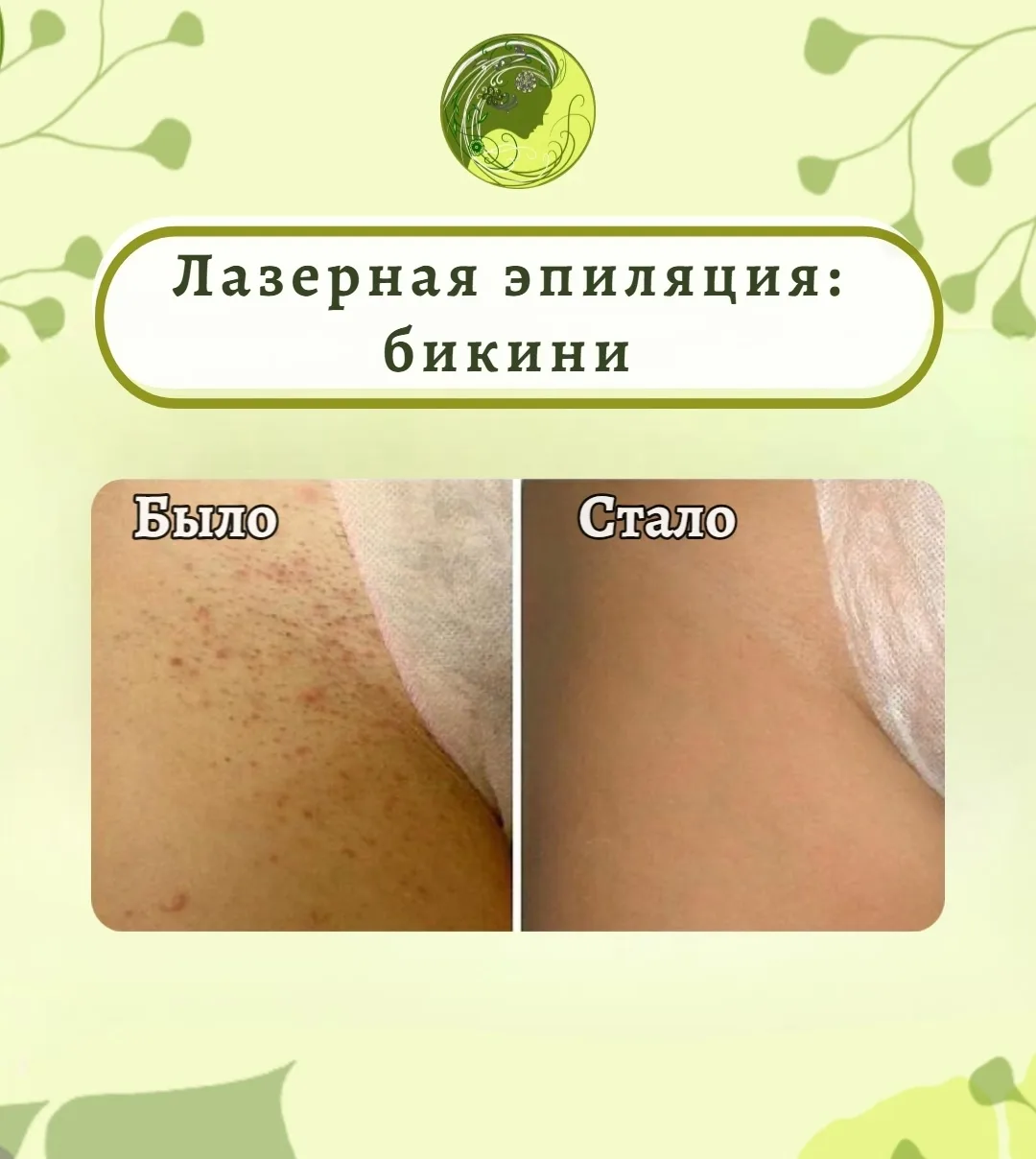 🧚‍♂️✨ Запишись на процедуру сегодня и начните путь к уверенности в себе!⬇️

🧩 Зона: бикини, класси