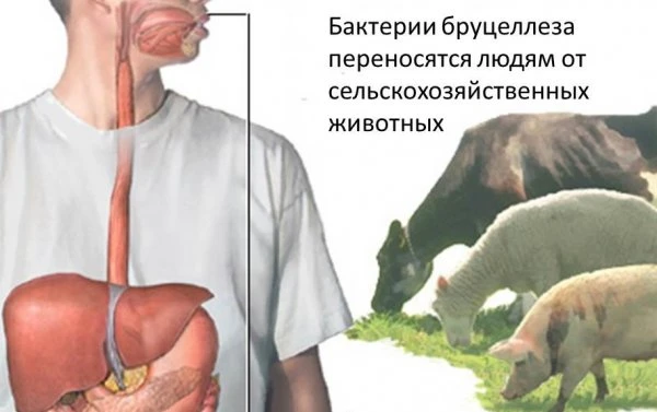 Для предупреждения заболевания бруцеллезом!
Бруцеллез — это зоонозная инфекция, передающаяся от боль