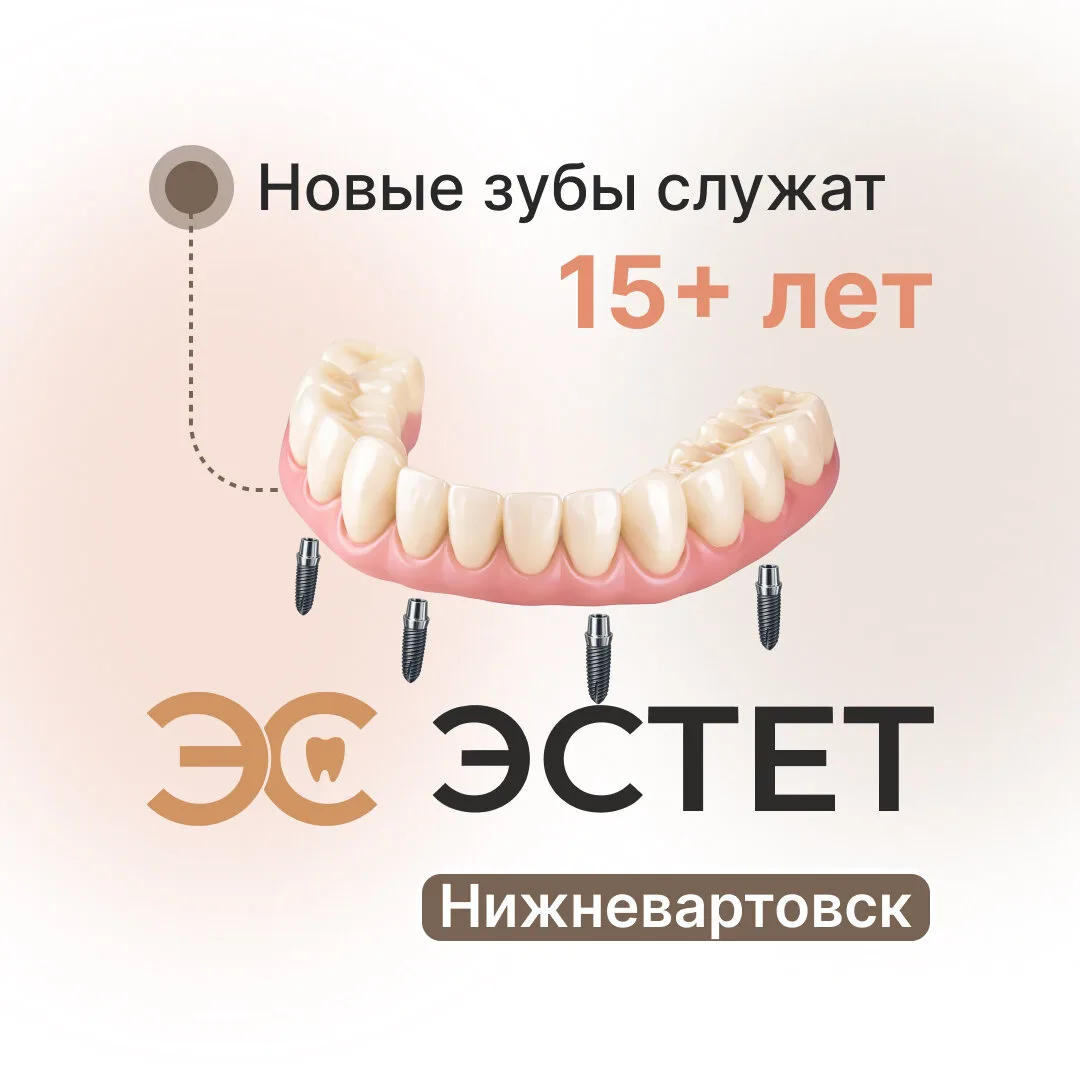 Имплантация «Все зубы сразу на 4-х имплантах». Вартовск

За 28 лет работы клиники «Эстет» не было ни