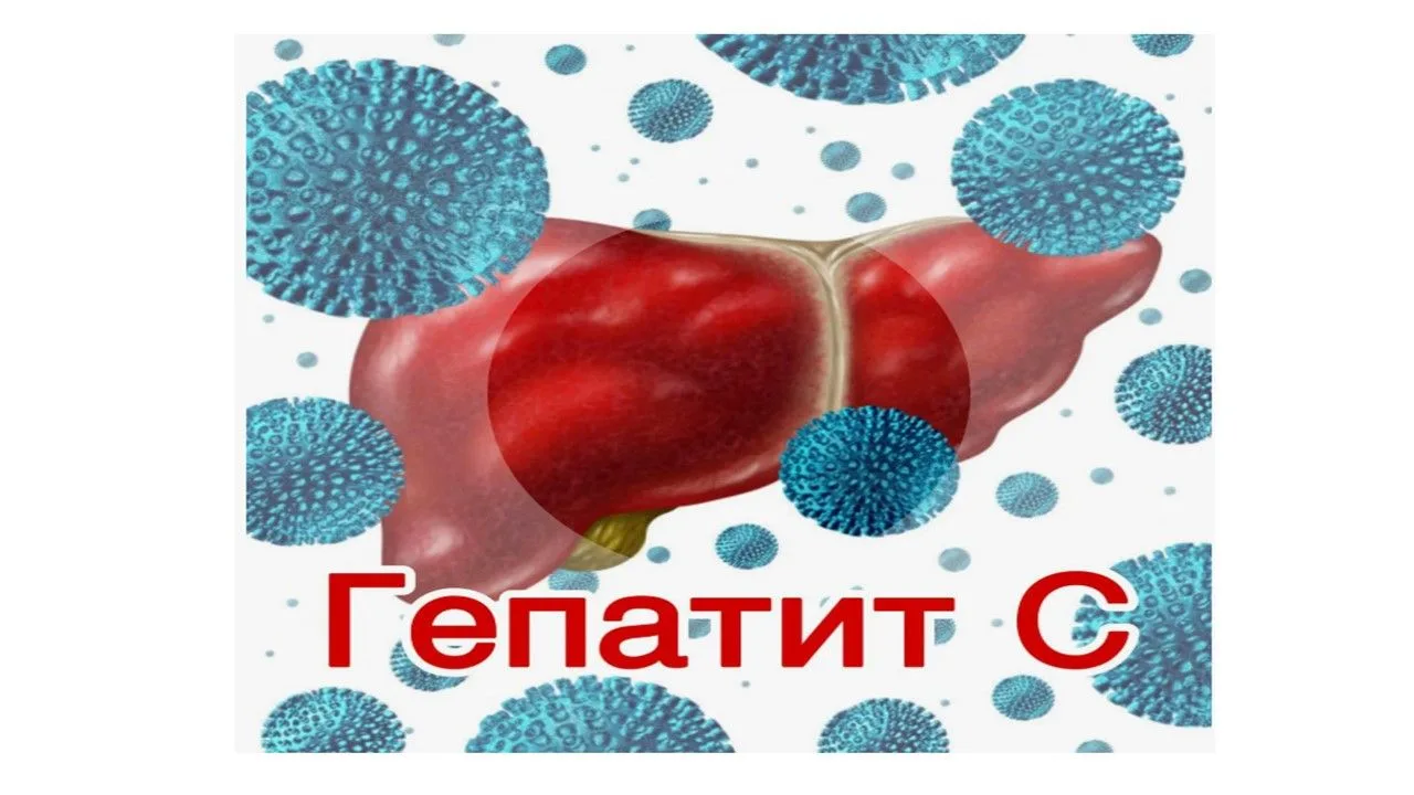Что такое гепатит С?Материалы для ознакомления👆