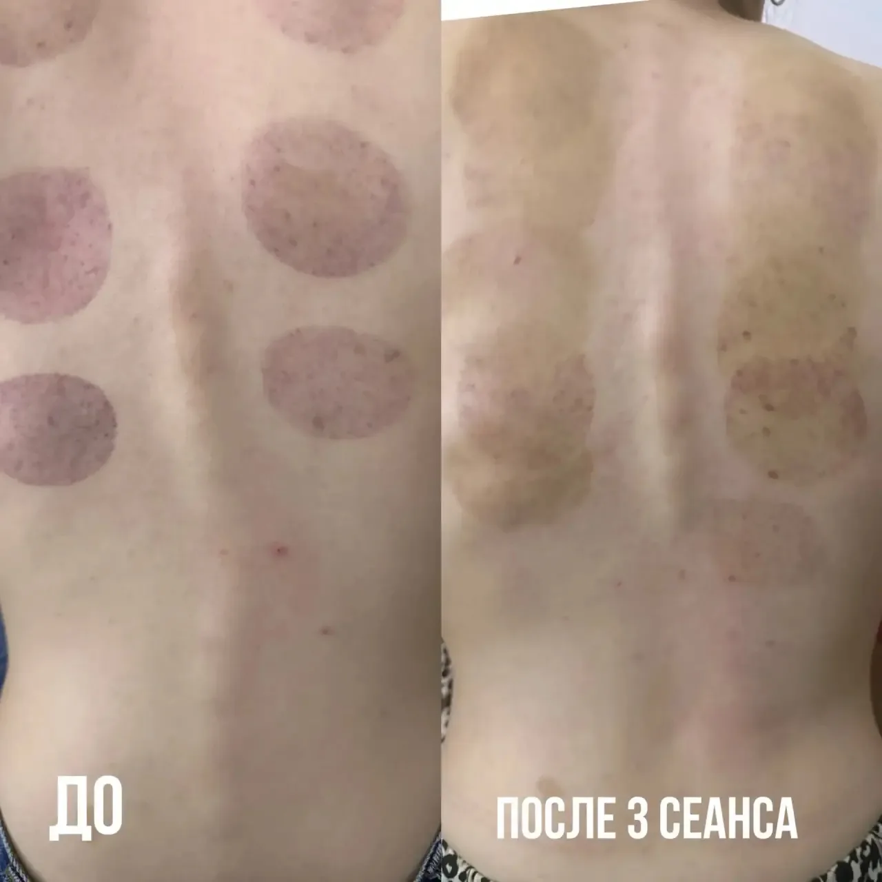 Посмотрите результат до и после 🔥🔥🔥