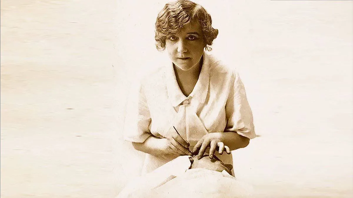 Сюзанна Ноэль (1878–1954) : Первая в мире женщина-пластический хирург.

- её техника подтяжки лица, 