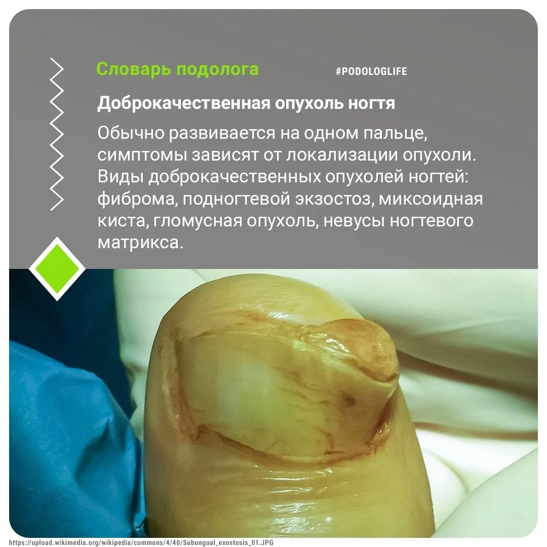#словарьподолога #словарьподологлайф