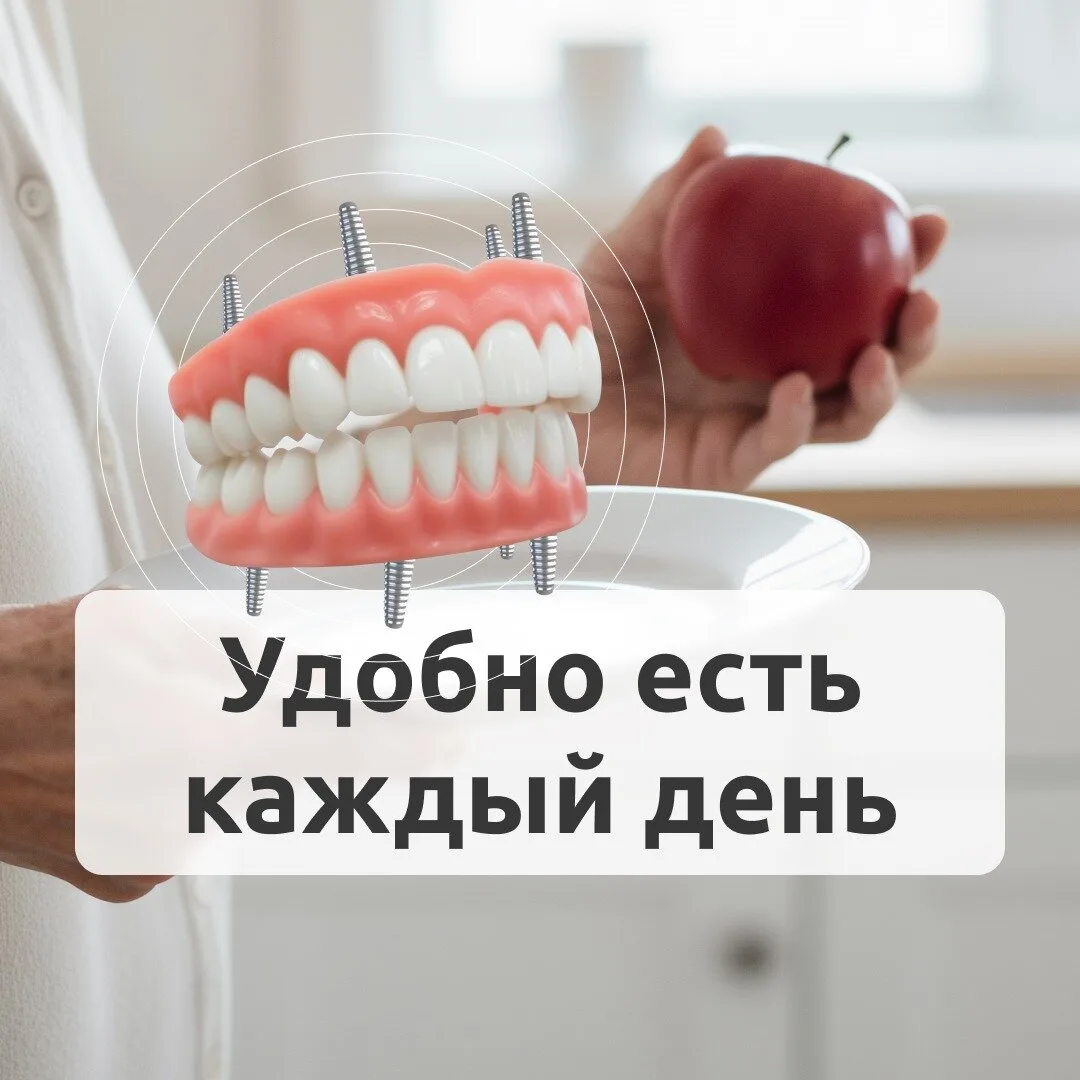 Имплантация всей челюсти на 4-х имплантах в Сочи!

«Гур.У. Клиник» — центр цифровой имплантации.
Ком