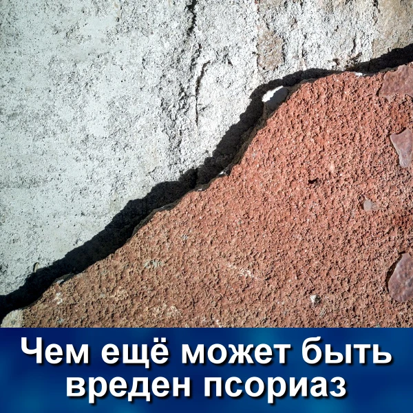 Чем еще может быть вреден псориаз? Помимо пятен на коже?

Тем, что люди с псориазом постоянно находя