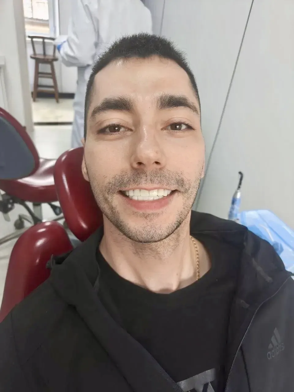 Артем  , город Тында

🦷План протезирования:

Верх - 5 мостов  , 14 единиц  
Низ - 4 моста  , 13 еди