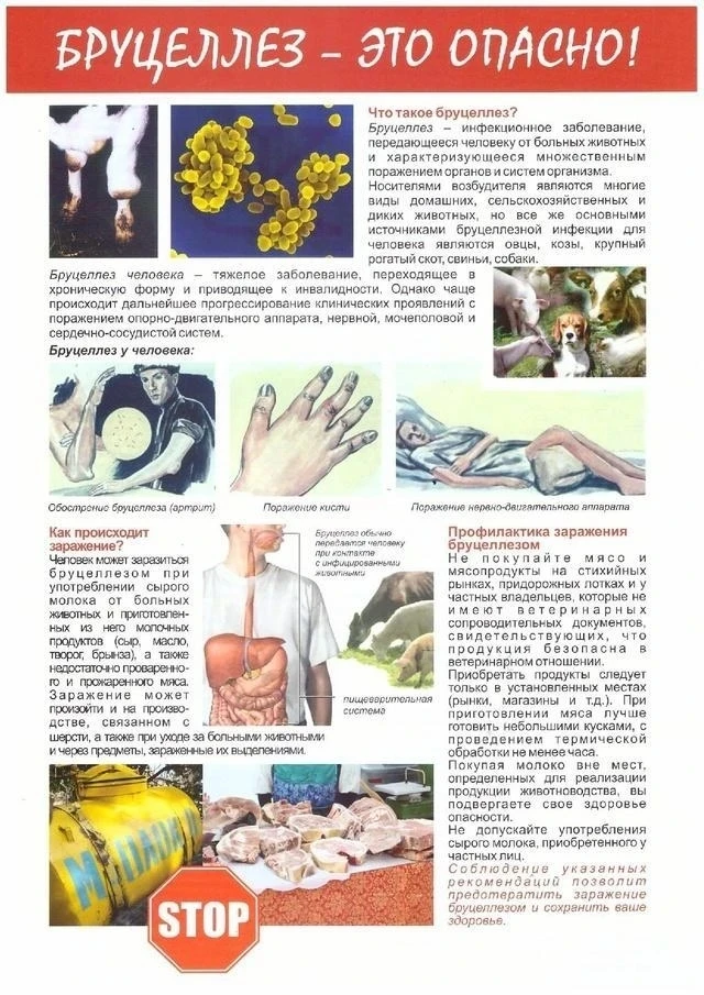 Бруцеллез – особо опасная инфекционная болезнь животных и людей, сопровождающаяся лихорадкой, пораже