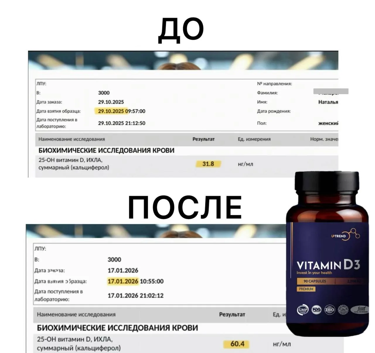 Ловушка больших цифр витамина Д3: почему 5000 МЕ могут работать хуже, чем 2000 МЕ?

Мы привыкли дума
