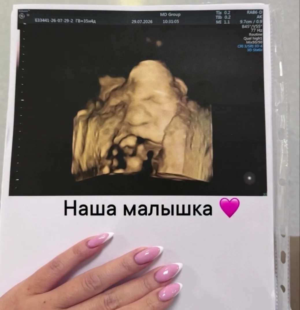 Вес 2.450гр
У меня все детки родились небольшие )
Андрюша 3.150
А Мия 2.850
