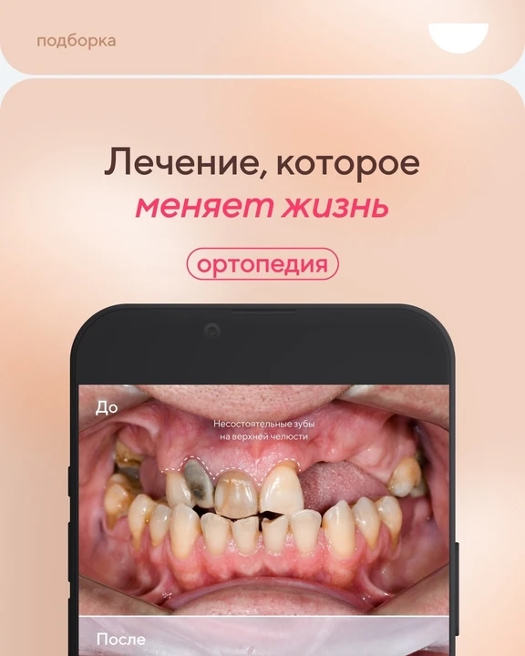 Собрали 5 впечатляющих «до–после» по ортопедии за последние полгода в Ренидент Девяткино.

Каждый сл