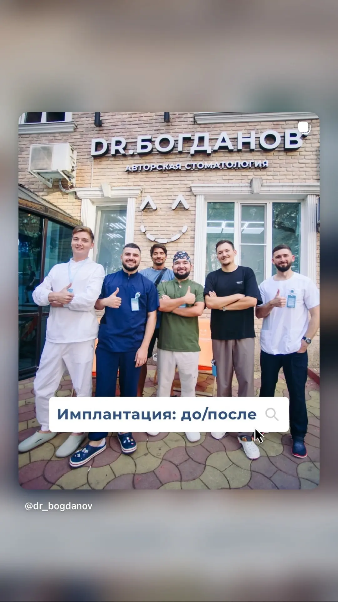 Посмотрите, какая потрясающая улыбка получилась у нашего пациента.

В данном случае мы удалили зубы 