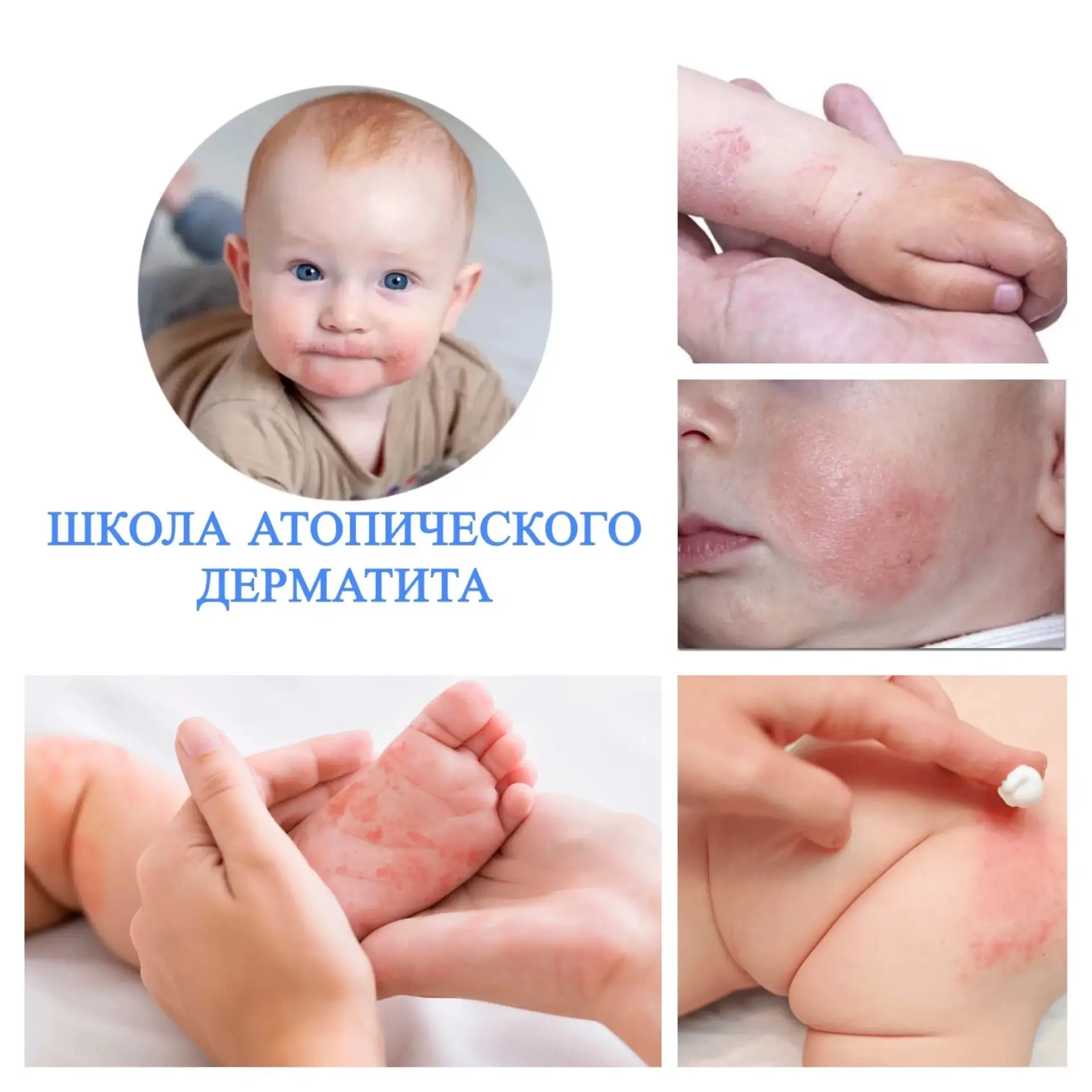 С 01.06.2025 по 07.06.2026 — Неделя сохранения здоровья детей. 
📣Напоминаем, что если у вашего ребе