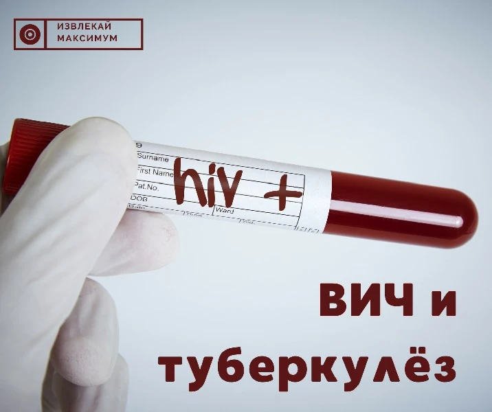 снижение веса.

Люди, живущие с ВИЧ, нуждаются в диспансерном наблюдении для психологической адаптац