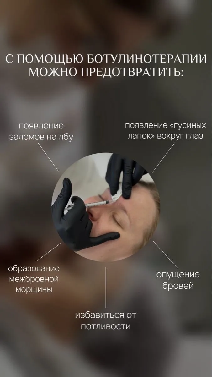Ботокс Фул Фейс по спец.цене👌🏼🔥🔥