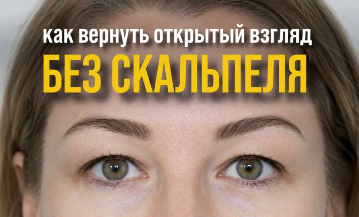 Убрать нависшее веко без операций. Реально?

Нависшее веко делает взгляд уставшим, а лицо визуально 