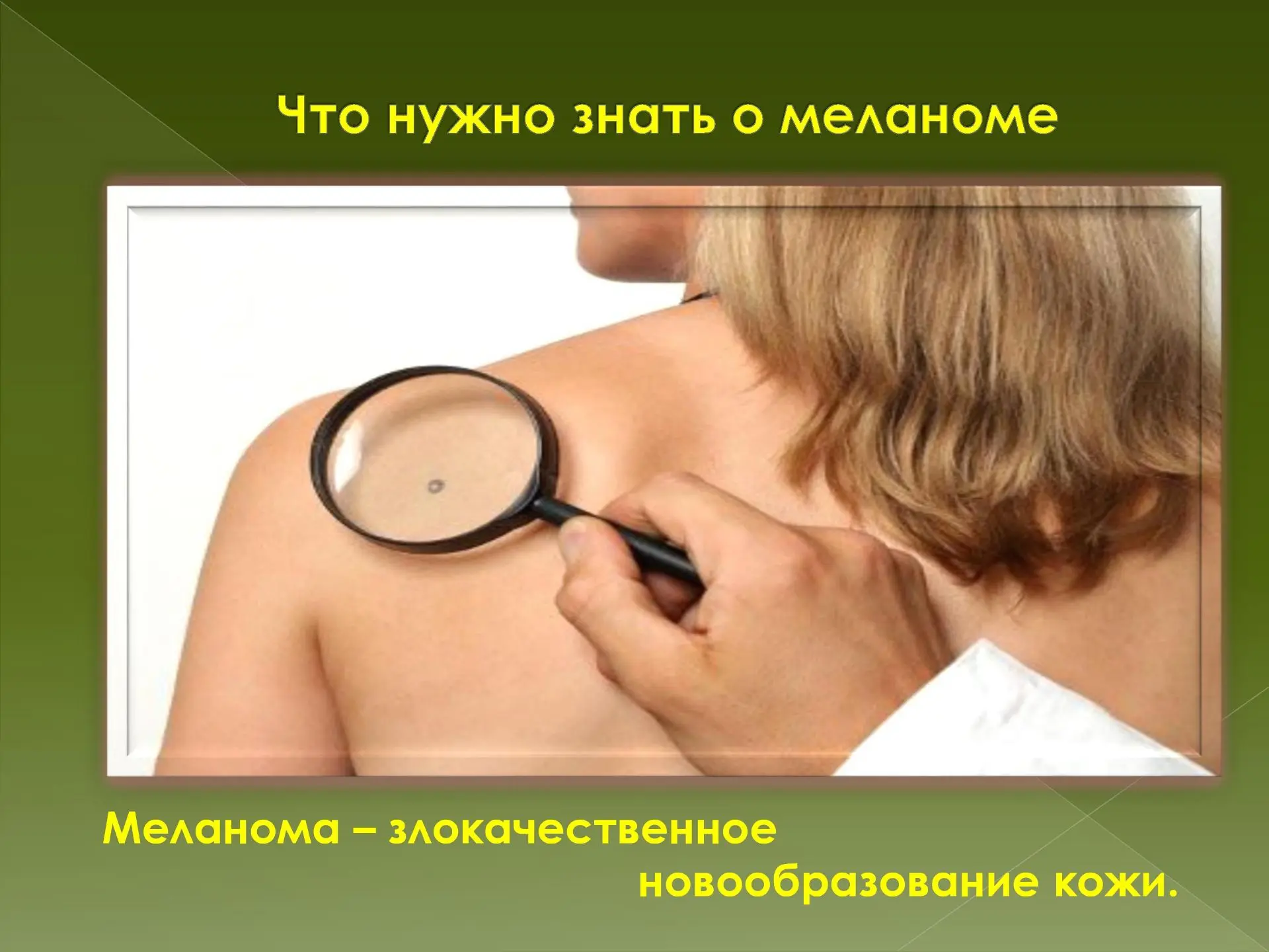 https://med-b-tavricheskaya-crb-r52.gosweb.gosuslugi.ru/novosti/melanoma.html