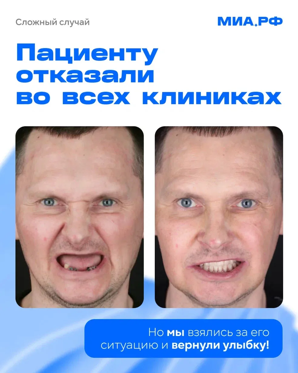 Разбираем сложный случай пациента — ему отказали во всех клиниках!

Основные трудности заключались в
