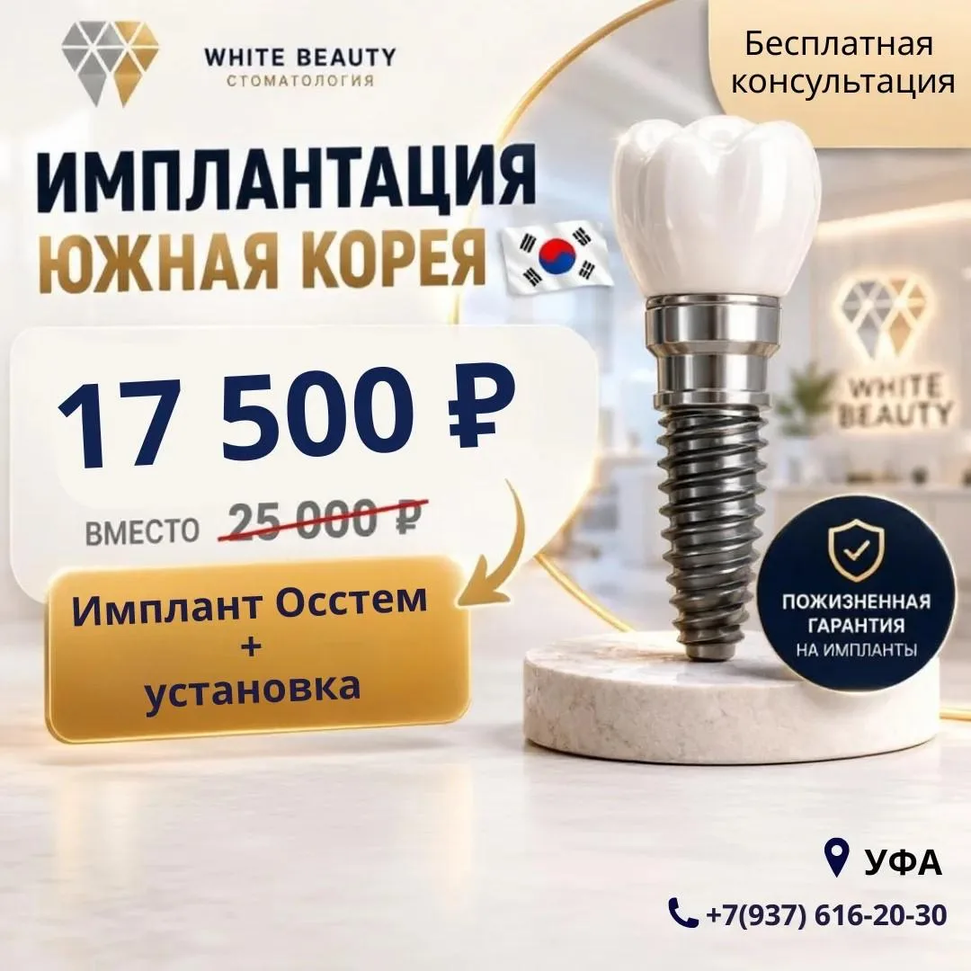Имплант Юж.Корея + установка за 17500 руб.

📌До 30 июня - уникальная возможность зафиксировать стои