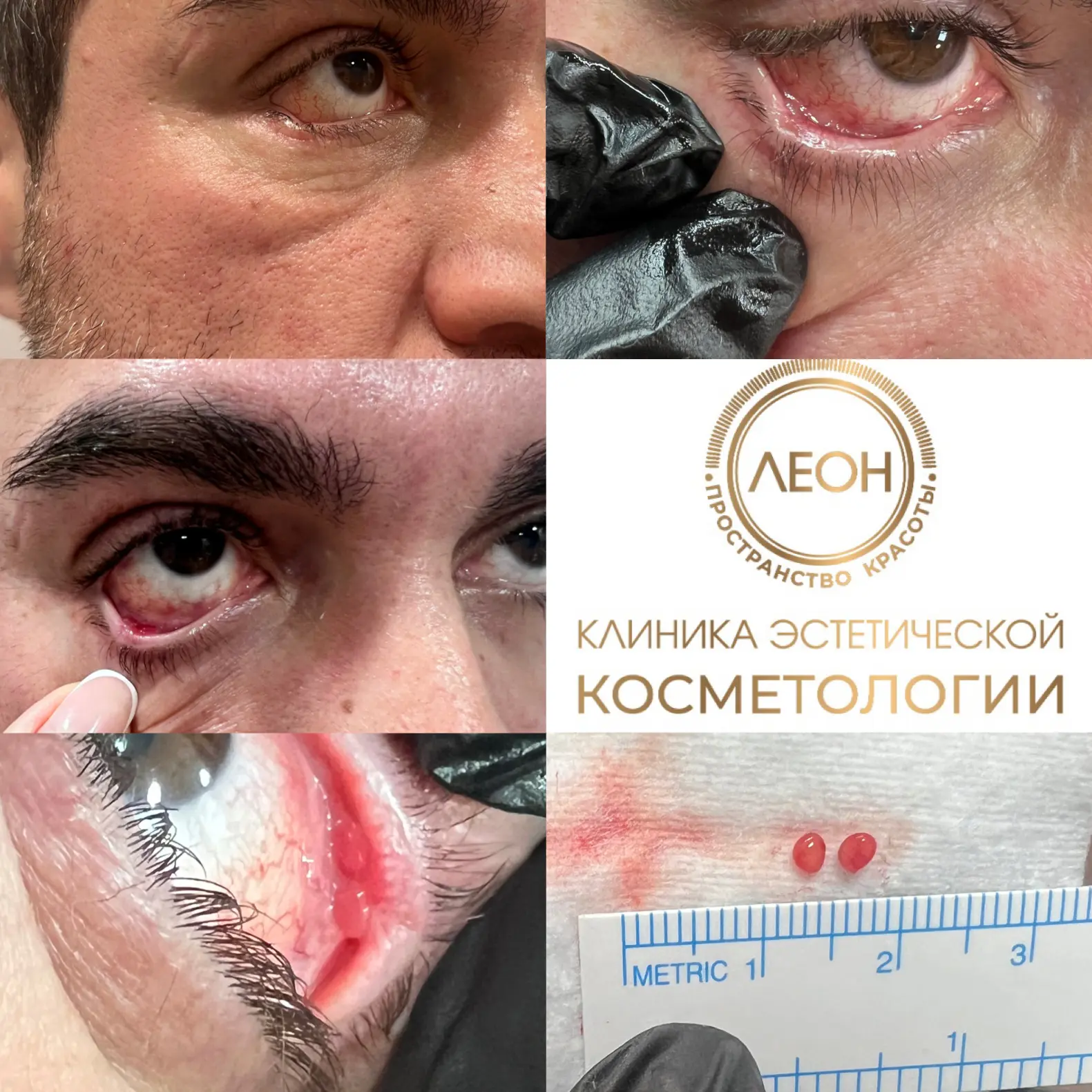 Знаете, иногда наш организм ведёт себя как очень заботливый, но чересчур тревожный друг: хочет защит