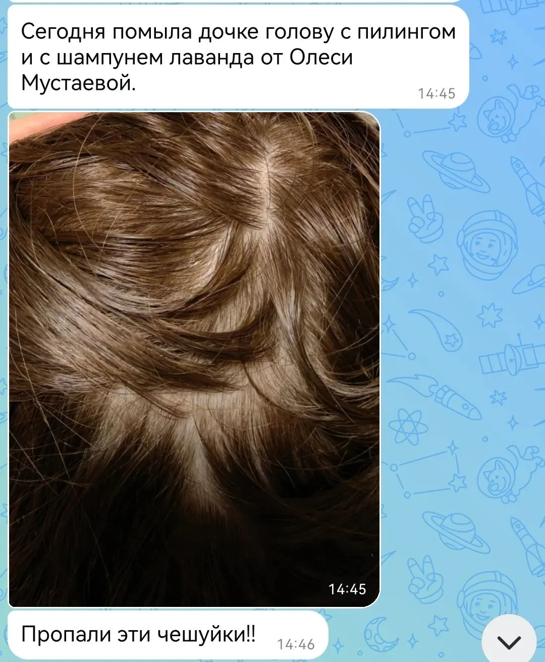 А теперь — отзыв мамы 👆

✨ Вот почему я всегда говорю: не всякое шелушение — это просто «перхоть».
