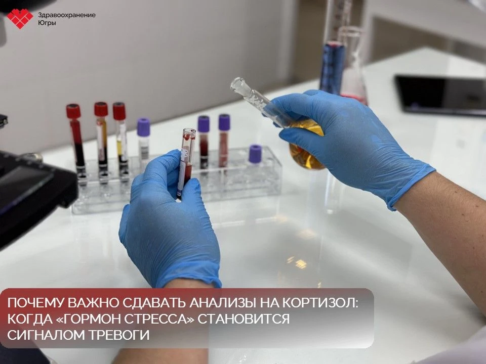 🧬 Кортизол: что нужно знать о «гормоне стресса»

Кортизол — стероидный гормон из группы глюкокортик