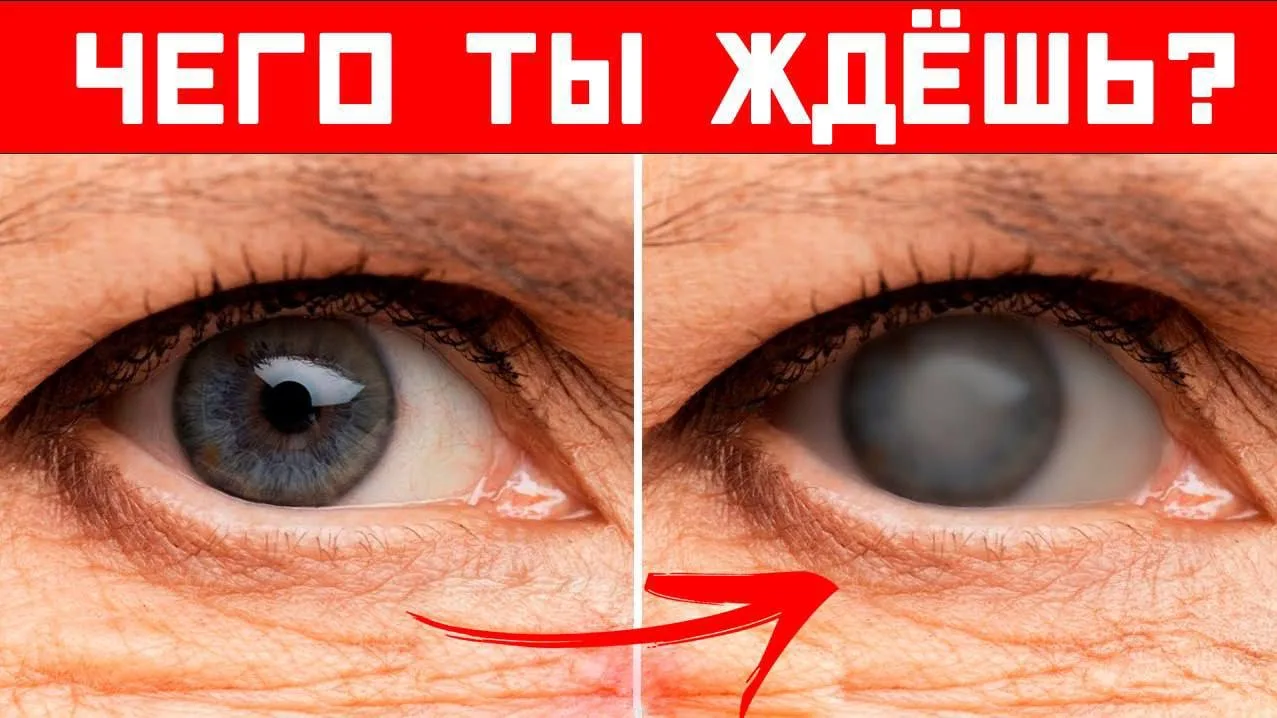 ❗️ ЗРЕНИЕ ВОЗВРАЩАЕТСЯ В ЛЮБОМ ВОЗРАСТЕ

«Ухудшение зрения, сухость глаз, пелена – это не просто воз