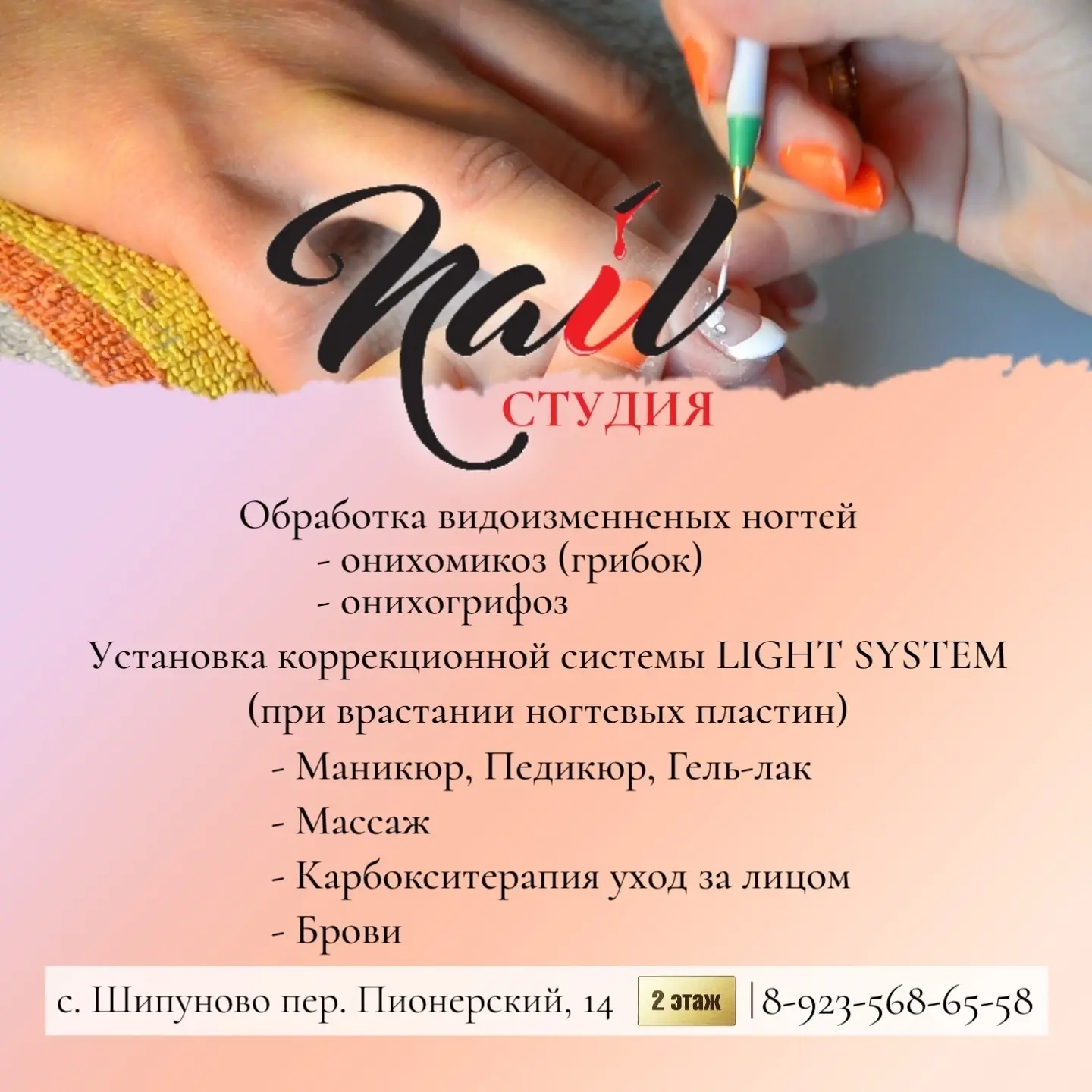 Обработка видоизмененных ногтей

🌸 онихомикоз (грибок)
🌸 онихогрифоз

Установка коррекционной