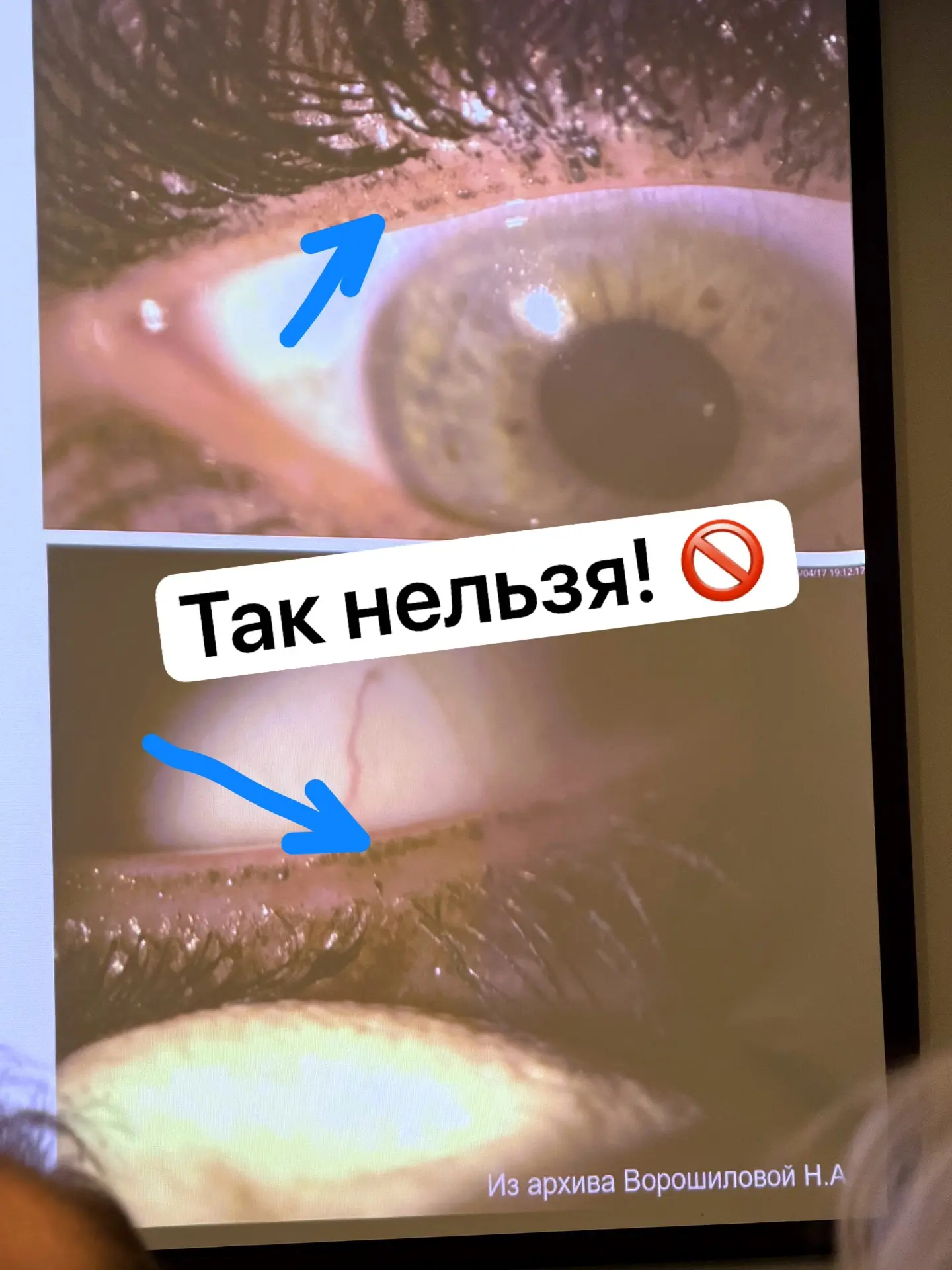 Ошибки макияжа 👀 

Продолжаю разбирать записи с  «Белых ночей». Некоторыми фактами нужно делиться н