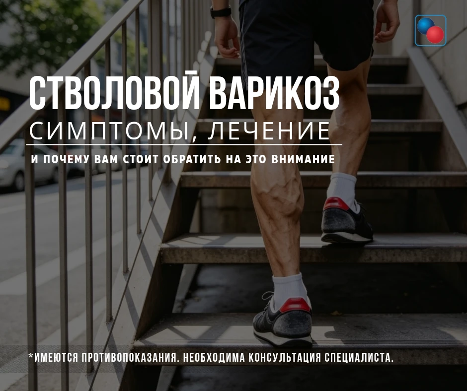 📢 СТВОЛОВОЙ ВАРИКОЗ: симптомы, лечение и почему вам стоит обратить на это внимание. 

Начнём с глав