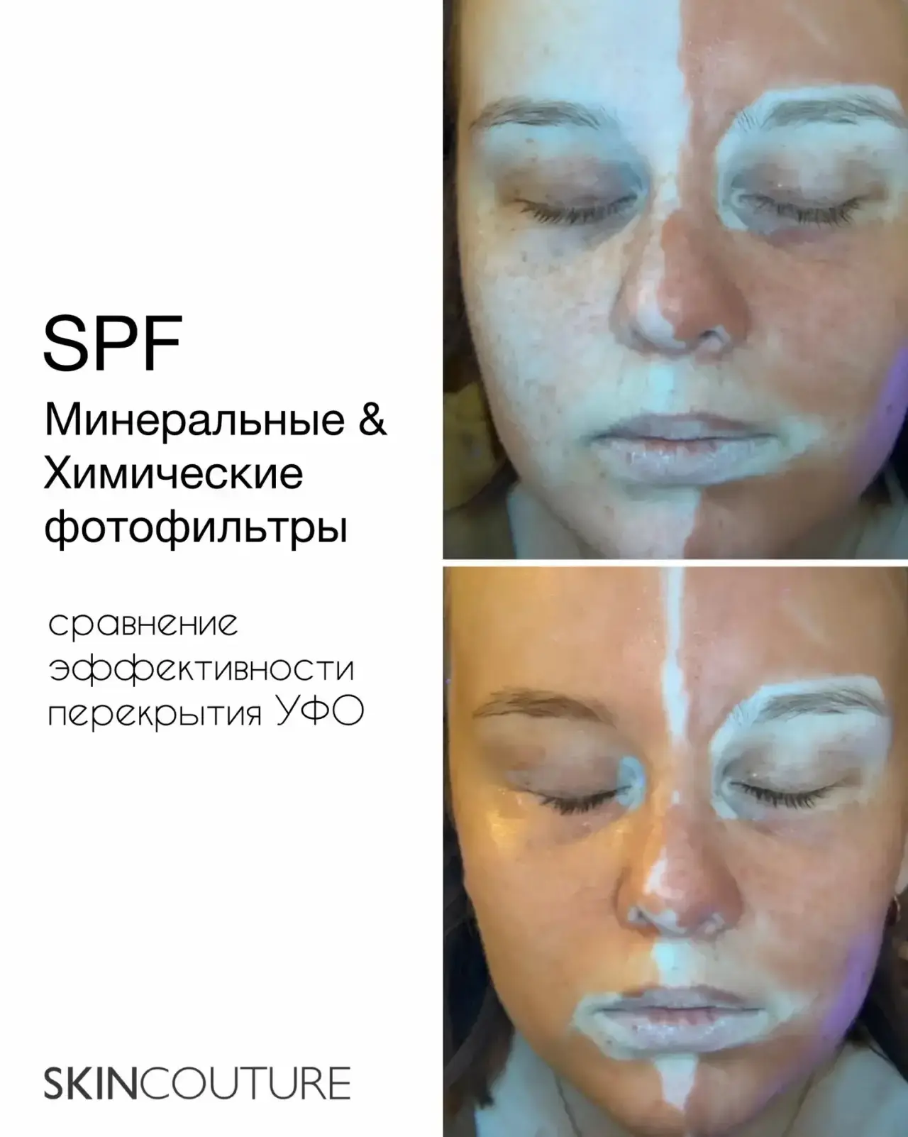 Если у вас до сих пор есть сомнение: использовать SPF или нет, данные фото позволят принять верное р