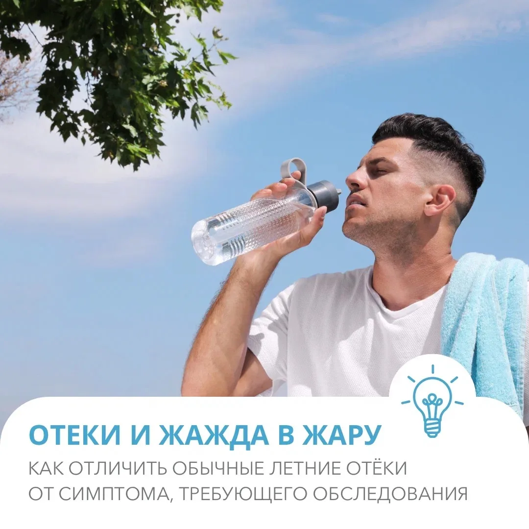 Летом каждый из нас всё чаще замечает, что к вечеру обувь становится теснее, а привычные кольца сним