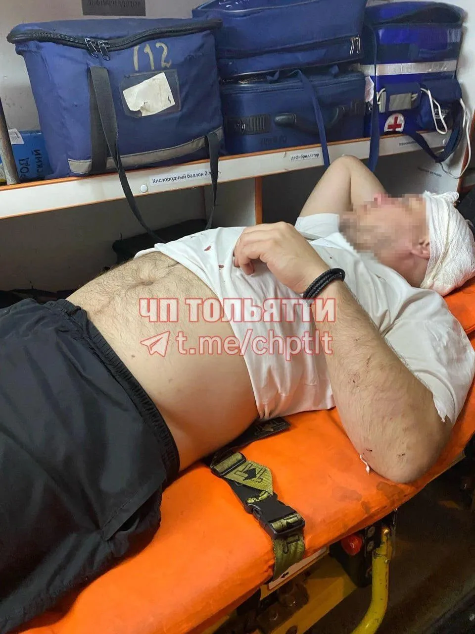 🔴«Выскочили три урода»: в Тольятти пешеходу проломили голову

Дорожный конфликт перерос в уголовное