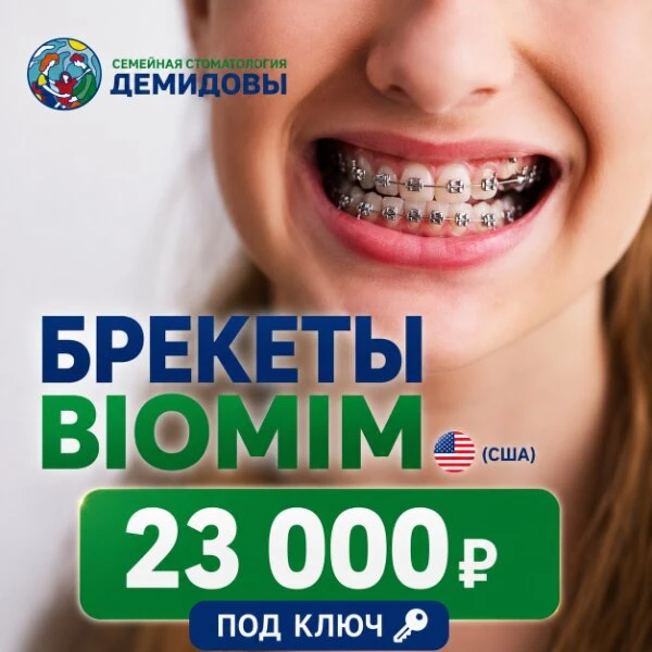 Брекеты Biomim (США) 23 000₽

Ребёнку нужны брекеты?

Важно не просто выровнять зубы, а сохранить зд