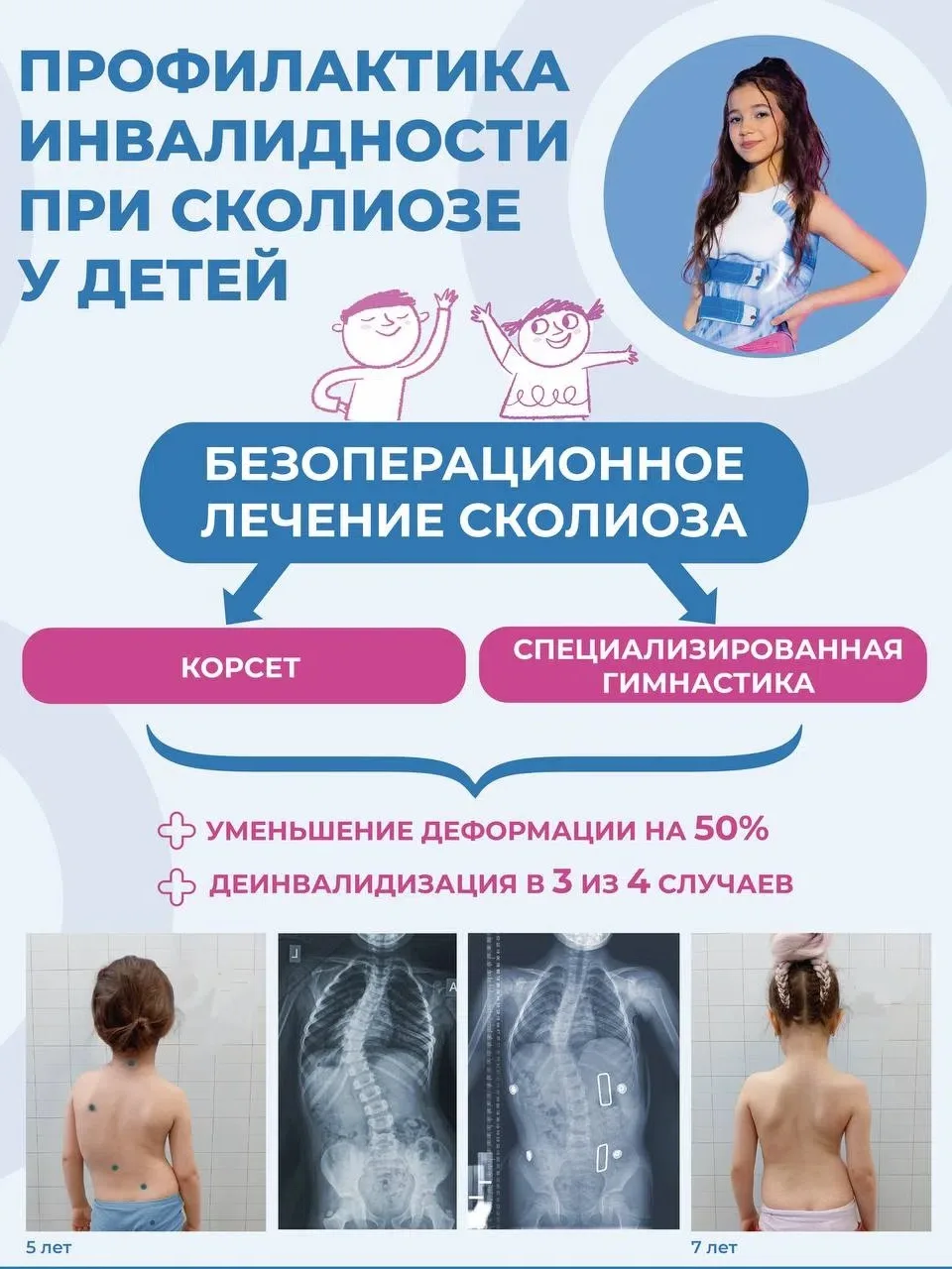 Сколиоз у детей — тихая угроза, которая не проходит сама!

Подавляющее большинство детей имеют пробл